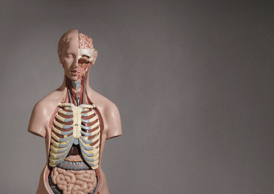 Model of a human torso. This model has been a great aid to multiple juries in understanding the complexities of surgery.