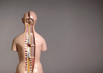 Medical model of a human torso. This model has been used with great success in cases involving spinal surgery.
